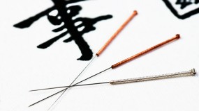 Acupuncture